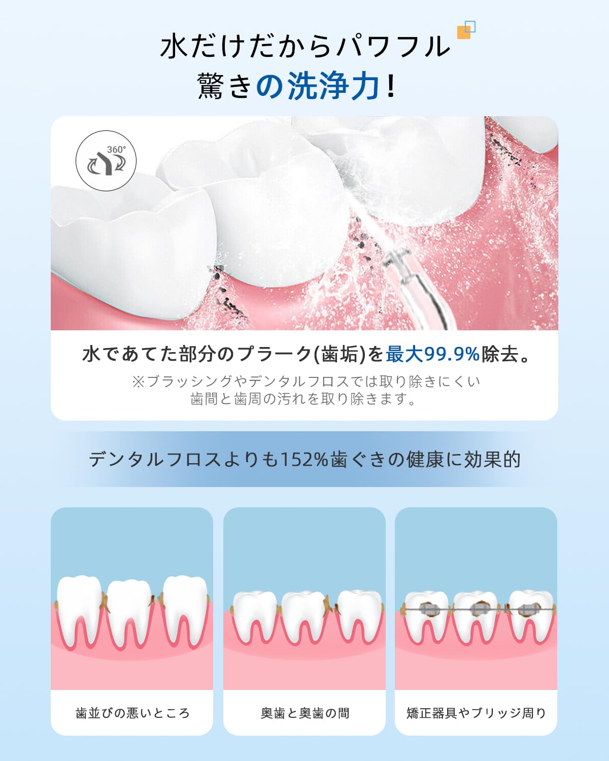 Amazon.co.jp: 口腔洗浄器 ジェットウォッシャー替えノズル4本 4種類